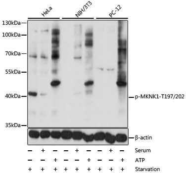 Anti-Phospho-MKNK1-T197/202 Antibody (CABP0544)