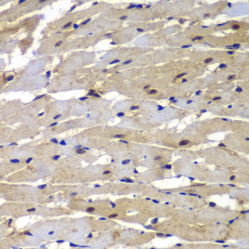 Anti-PSMB8 Antibody (CAB7340)