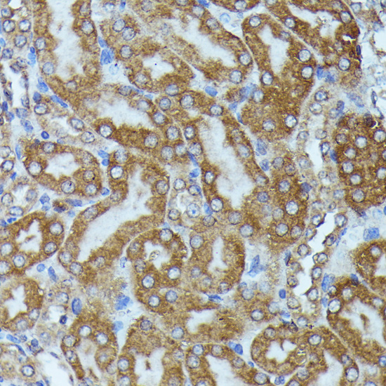 Anti-TBCB Antibody (CAB13248)