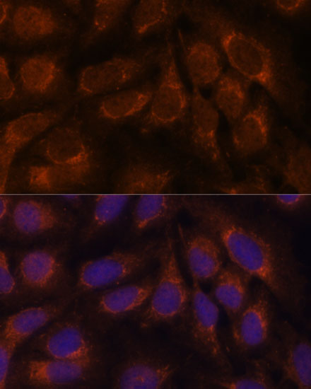 Anti-CREB3 Antibody (CAB6567)