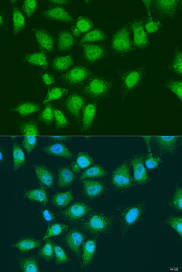 Anti-EYA3 Antibody (CAB15056)