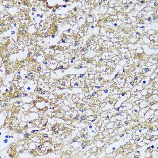 Anti-NQO2 Antibody (CAB11746)