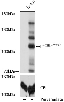 Anti-Phospho-CBL-Y774 pAb (CABP0794)