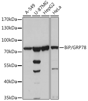 Anti-BiP/GRP78 Antibody (CAB0241)