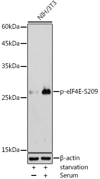 Anti-Phospho-eIF4E-S209 Antibody (CABP0747)