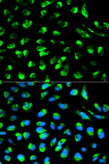 Anti-ECI1 Antibody (CAB1211)