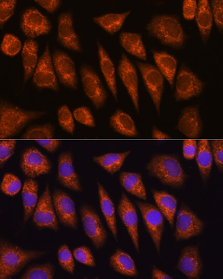 Anti-GOLGA4 Antibody (CAB10216)