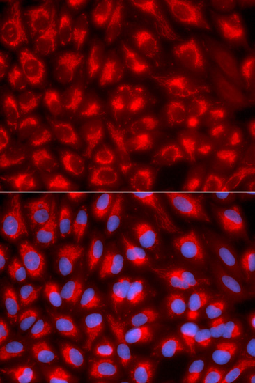 Anti-TFAM Antibody (CAB1926)