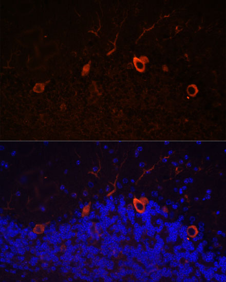 Anti-KAL1 Antibody (CAB16389)