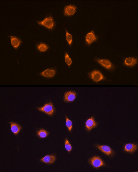 Anti-TRH Antibody (CAB14472)