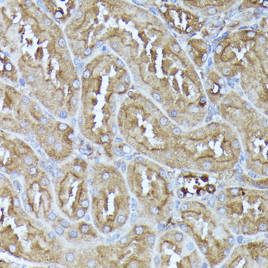 Anti-DLAT Antibody (CAB14530)