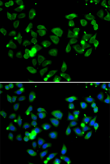 Anti-CARD11 Antibody (CAB7140)