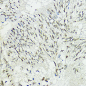 Anti-ZEB1 Antibody [KO Validated] (CAB1500)