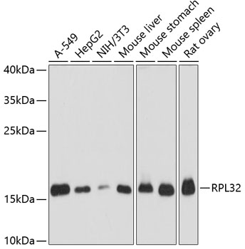 Anti-RPL32 Antibody (CAB13001)