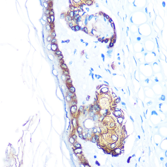 Anti-KRT14 Antibody (CAB15069)