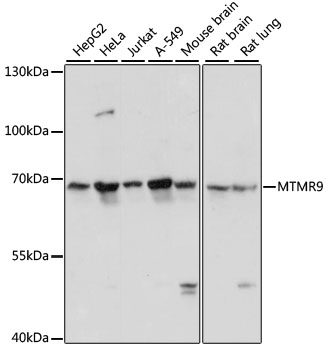 Anti-MTMR9 Antibody (CAB13124)