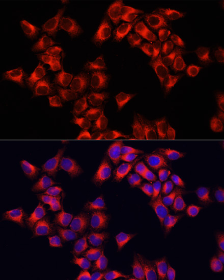 Anti-ARHGAP1 Antibody (CAB3739)