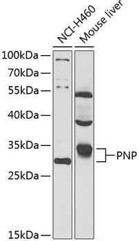 Anti-PNP Antibody (CAB14032)