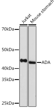 Anti-ADA Antibody (CAB5151)