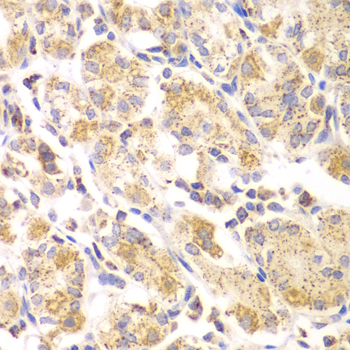 Anti-EYA3 Antibody (CAB7893)