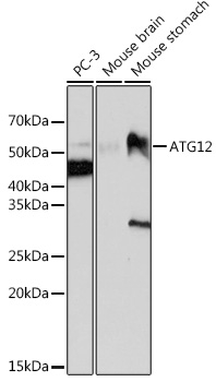 Anti-ATG12 Antibody (CAB19610)