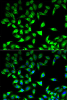 Anti-STAT4 Antibody (CAB6991)