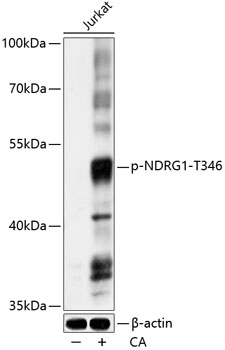 Anti-Phospho-NDRG1-T346 pAb (CABP0792)