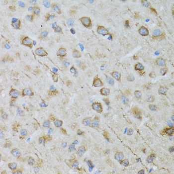 Anti-CRYM Antibody (CAB3810)