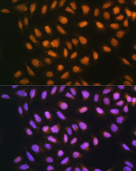 Anti-SREBP2 Antibody (CAB13049)