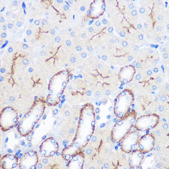 Anti-FCGR1A Antibody (CAB1197)