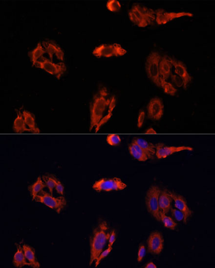 Anti-FAP Antibody (CAB6349)