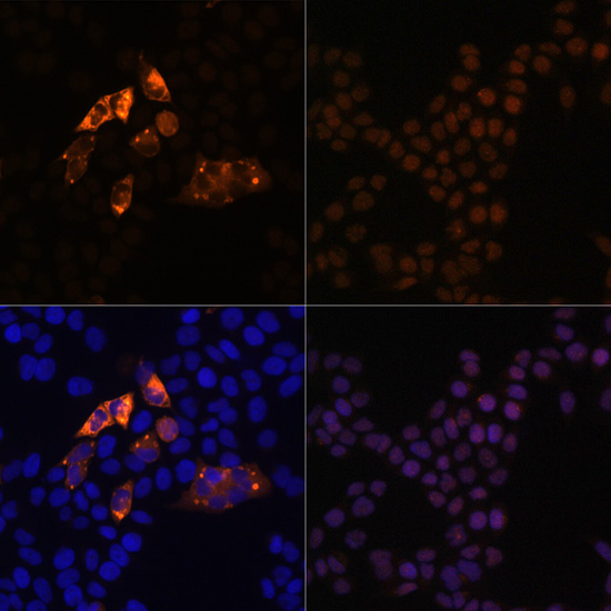 Anti-Rabbit anti Myc-Tag Polyclonal Antibody-C-terminal (CABE009)