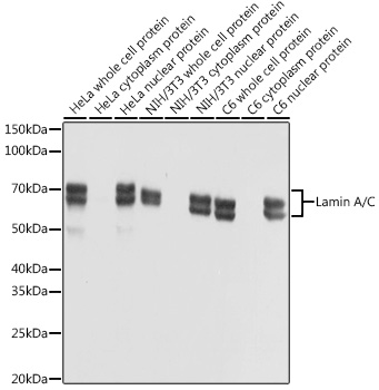 Anti-Lamin A/C Antibody [KO Validated] (CAB19524)