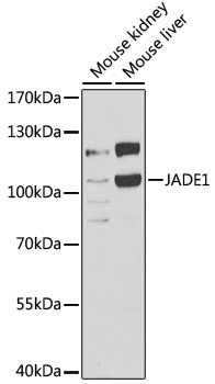 Anti-JADE1 Antibody (CAB6337)