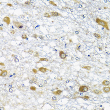 Anti-DDX39A Polyclonal Antibody (CAB7955)