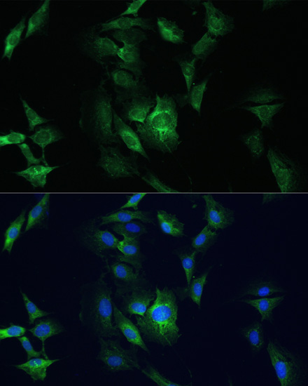 Anti-FADD Antibody (CAB16459)