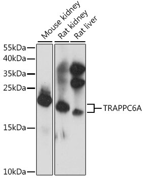 Anti-TRAPPC6A Antibody (CAB16143)