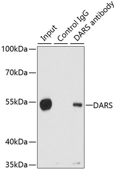 Anti-DARS Antibody (CAB6574)