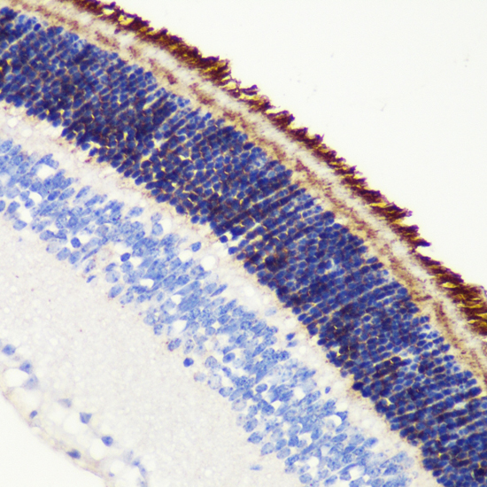 Anti-PDE6B Antibody (CAB6942)