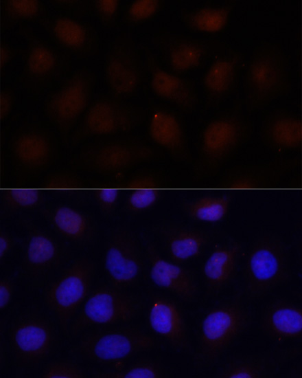 Anti-ACADSB Antibody (CAB15019)