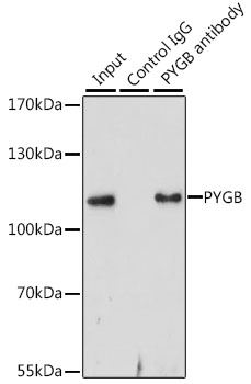 Anti-PYGB Antibody (CAB6402)