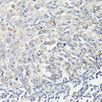 Anti-MUL1 Antibody (CAB13125)