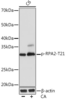 Anti-Phospho-RPA2-T21 Antibody (CABP1040)