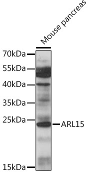 Anti-ARL15 Antibody (CAB16127)
