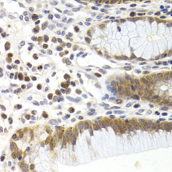 Anti-CDK6 Antibody (CAB3165)