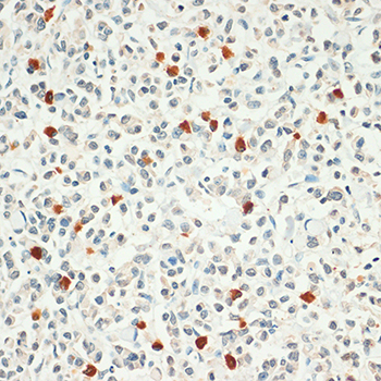 Anti-FOXP3 Polyclonal Antibody (CAB8024)