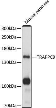 Anti-TRAPPC9 Antibody (CAB15527)