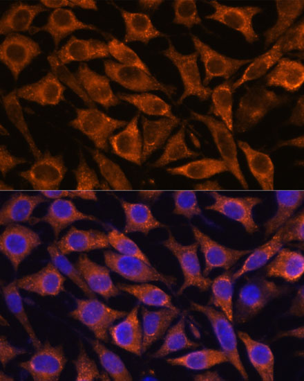 Anti-IFITM3 Antibody [KO Validated] (CAB13070)