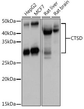 Anti-CTSD Antibody (CAB13292)