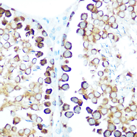 Anti-STIP1 Antibody (CAB14106)